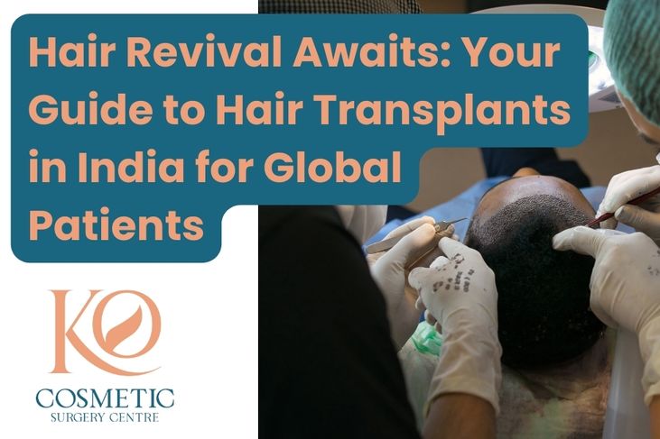 Hair-Revival-Awaits-Your-Guide-to-Hair-Transplants-in-India-for-Global-Patients-1