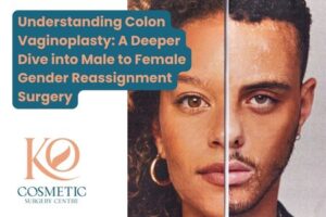 Understanding Colon Vaginoplasty A Deeper Dive into Male to Female Gender Reassignment Surgery